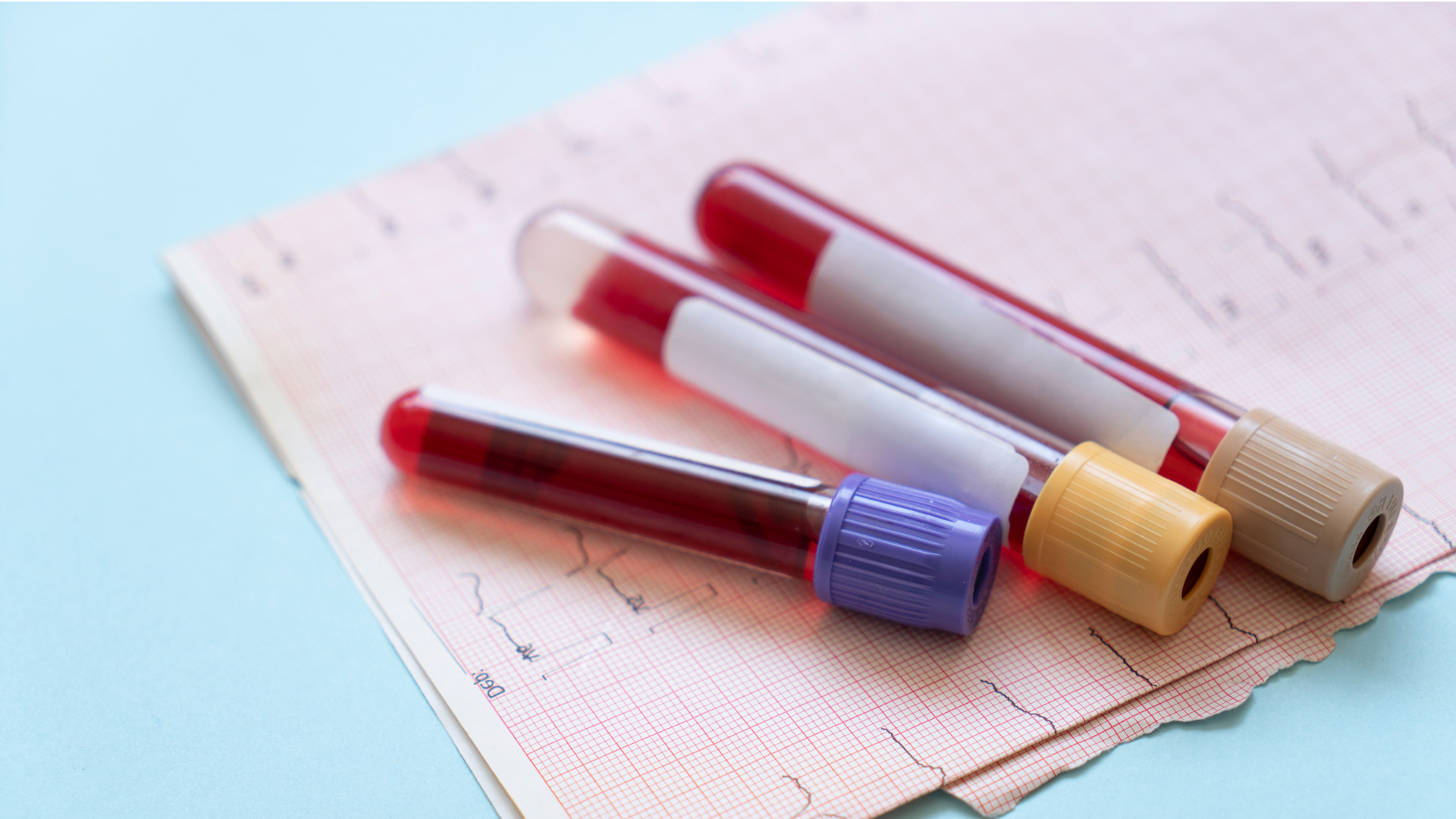 Blood samples collected to test mCVDRisk score, a new blood test that integrates next-generation diagnostics into heart health checks to offer a clearer, more personalised picture of heart disease risk.