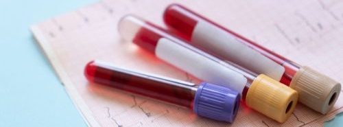 The mCVDRisk score is a new blood test that integrates next-generation diagnostics into heart health checks to offer a clearer, more personalised picture of heart disease risk.