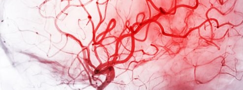 Detailed illustration of the human brain's blood vessels, showing a complex network of red arteries and veins against a light background.